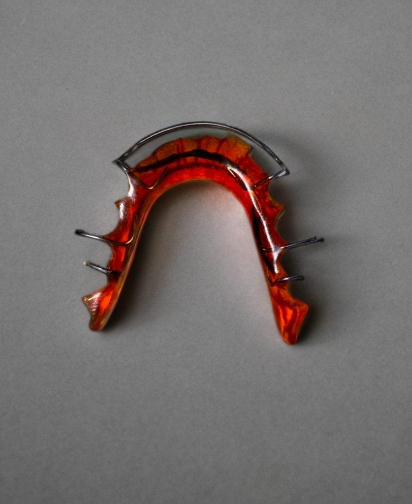 Hawley Retainer – Custom Orthodontic Appliance