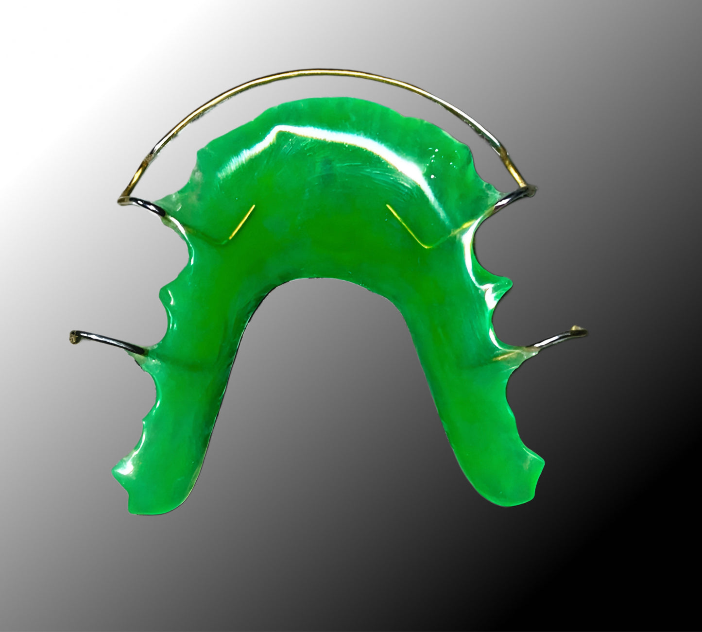 Hawley Retainer – Custom Orthodontic Appliance