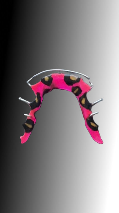 Lower custom Hawley retainer