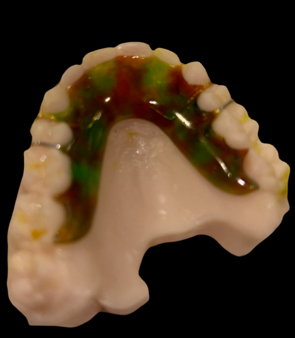 "Personalized Hawley retainer with camo acrylic"