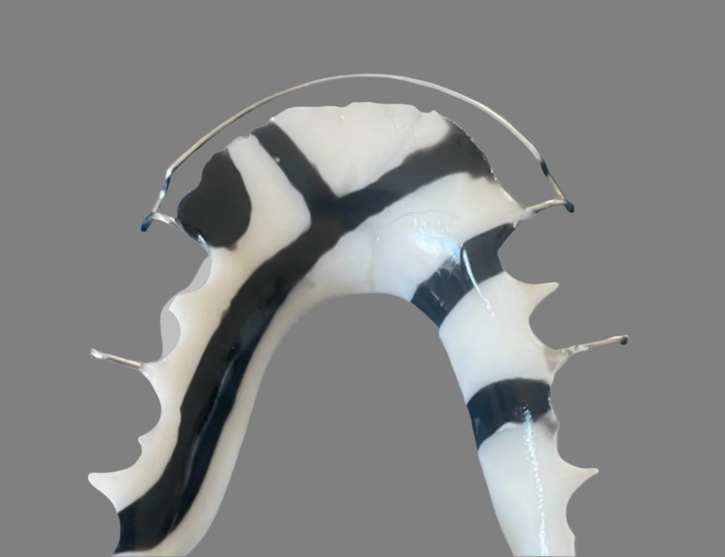 Hawley Retainer – Custom Orthodontic Appliance