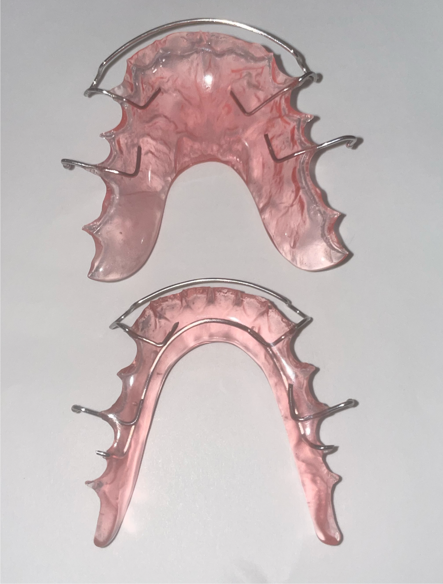 Hawley Retainer – Custom Orthodontic Appliance