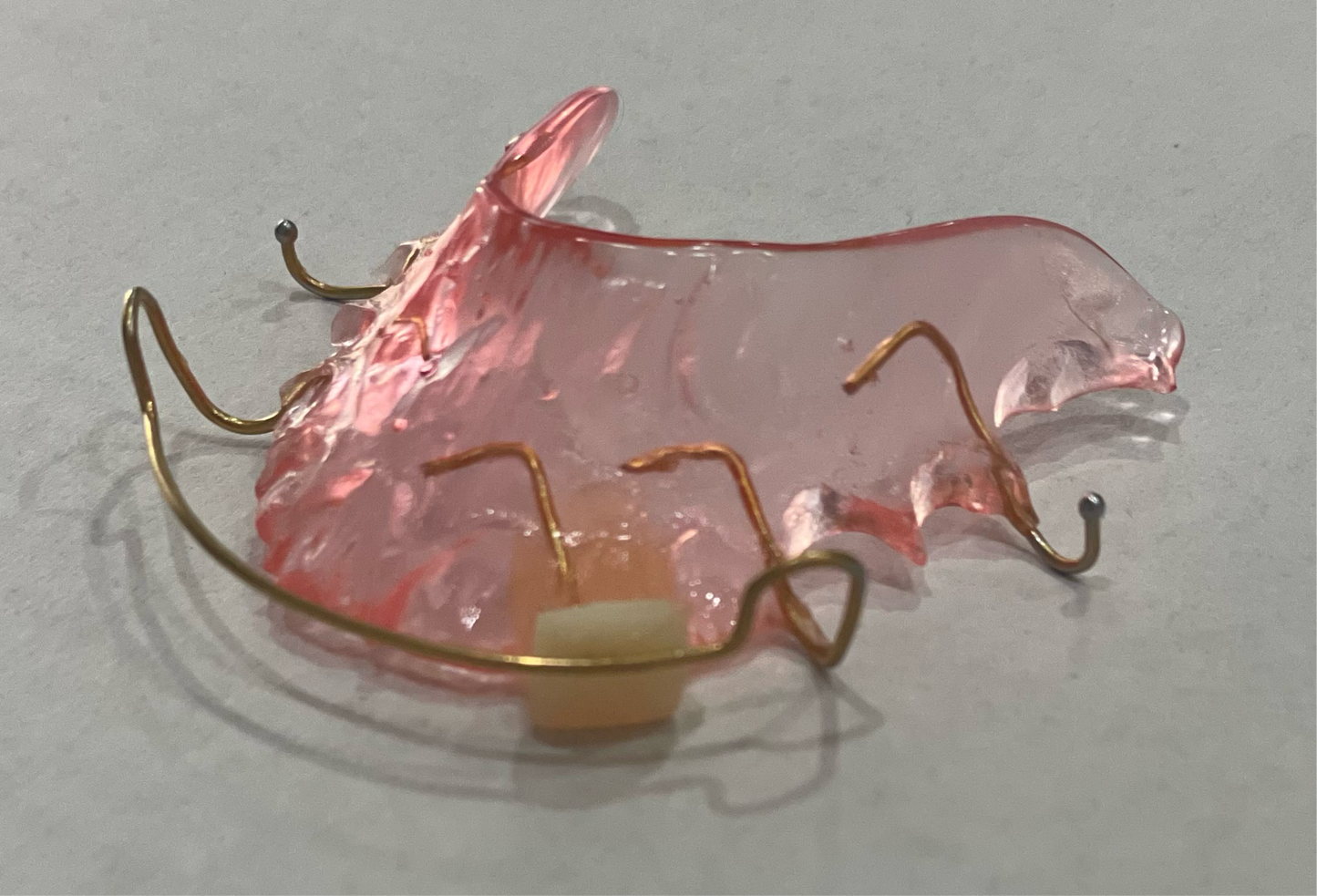 Retainer with Pontiac