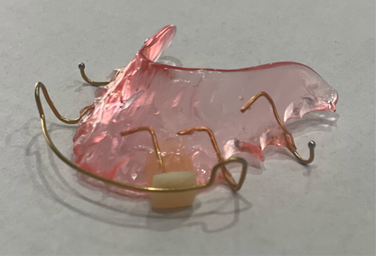 Retainer with Pontiac