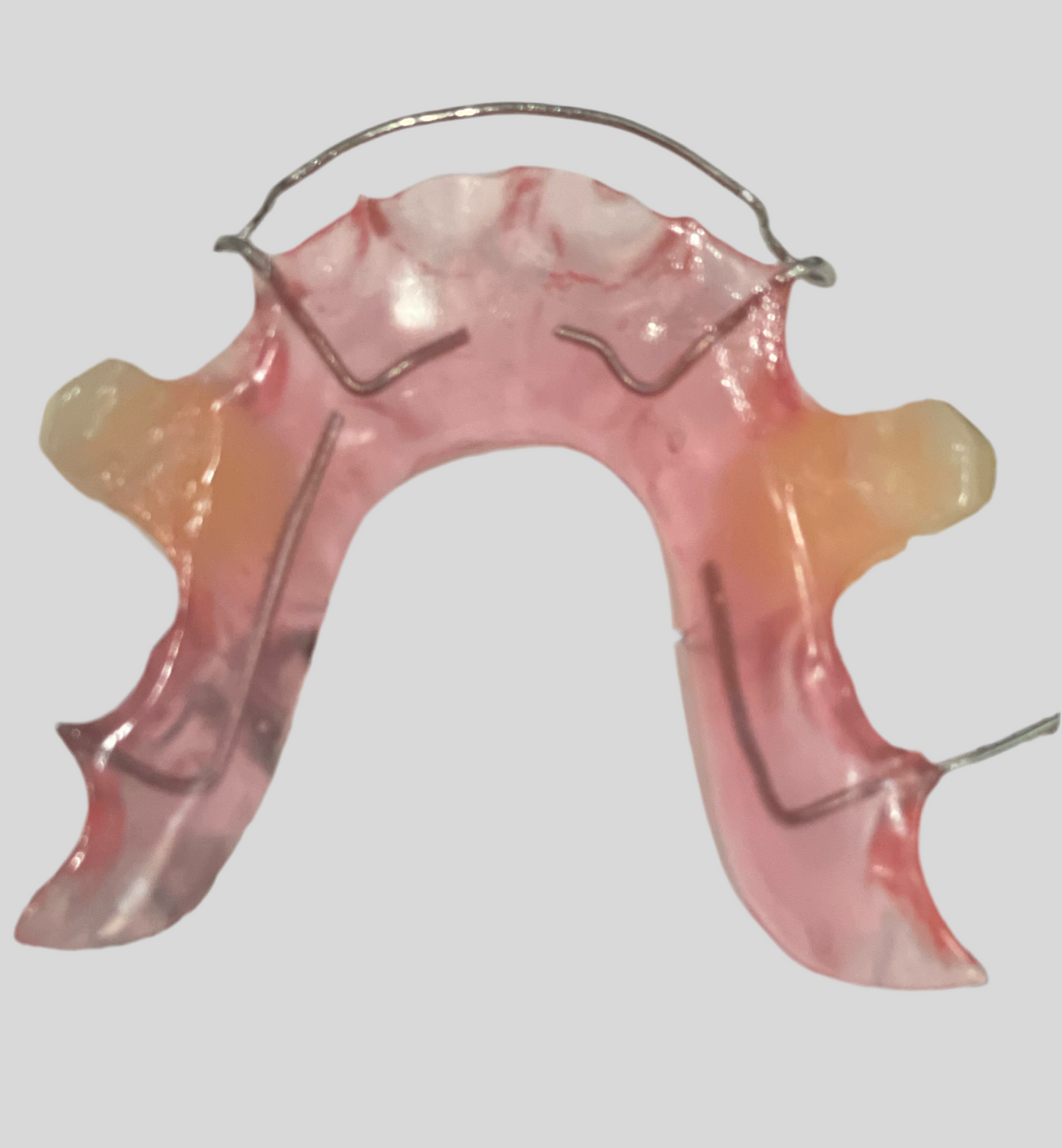 Retainer with Pontiac