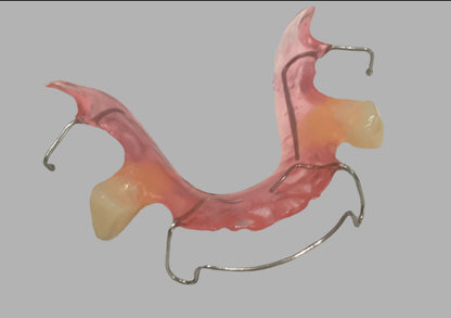 Retainer with Pontiac