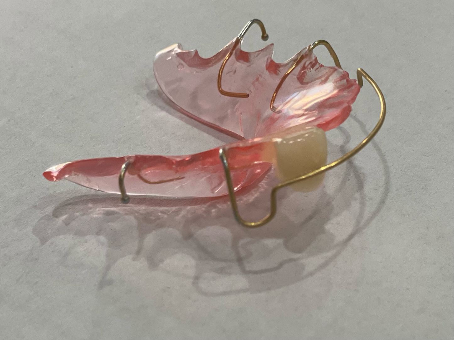 Retainer with Pontiac