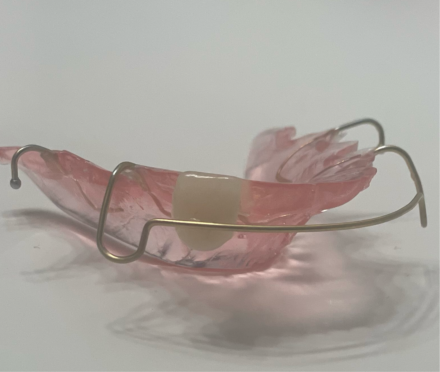 Retainer with Pontiac