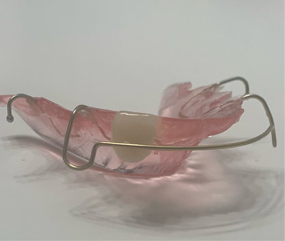 Retainer with Pontiac