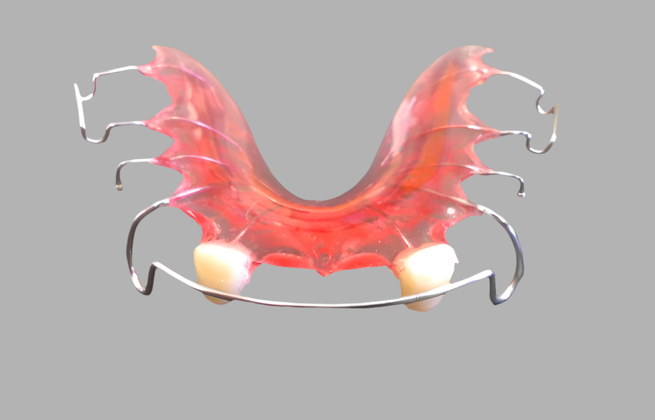 Retainer with Pontiac