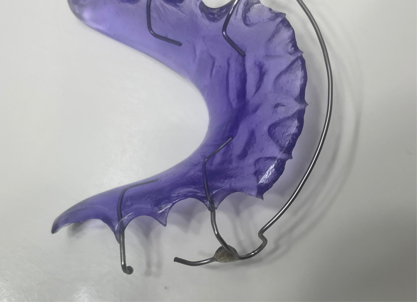 “Custom dental retainer with stainless steel soldered C clasps”