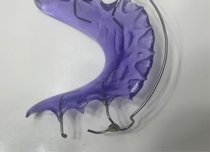 “Custom dental retainer with stainless steel soldered C clasps”