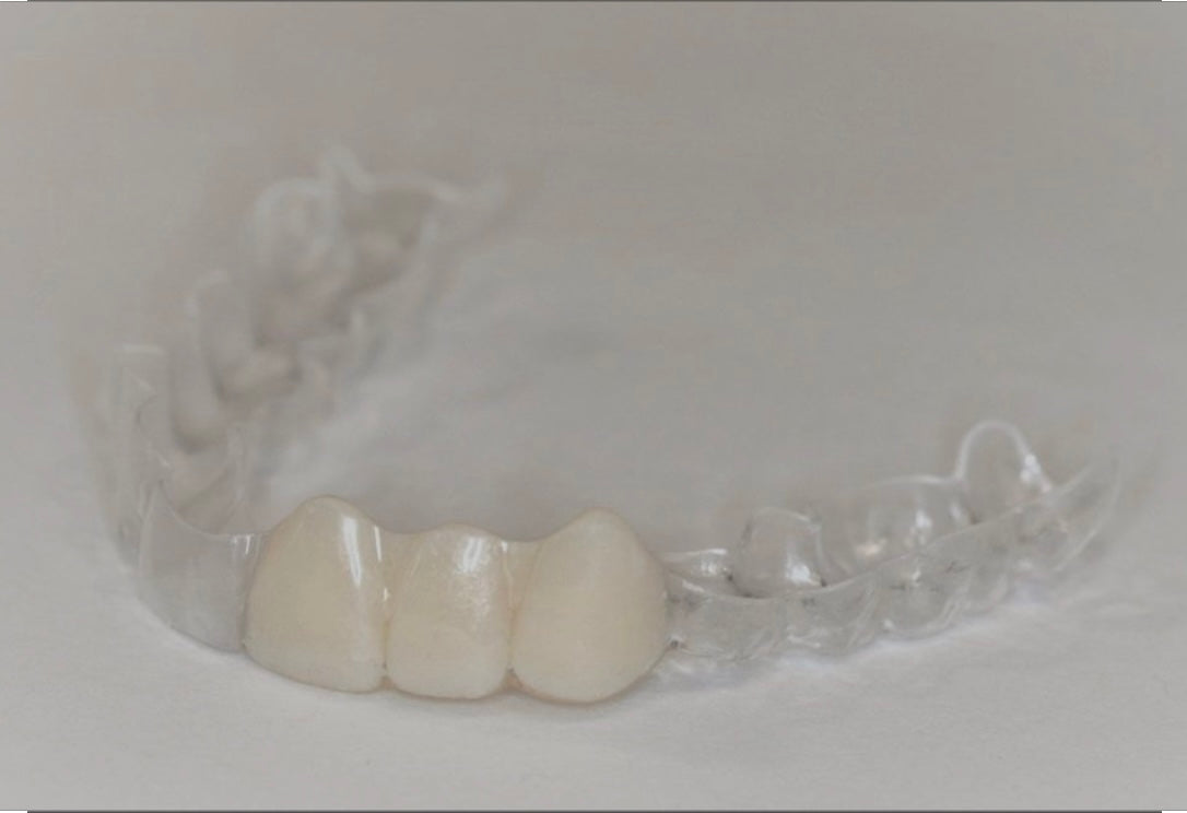 Retainer with Pontiac