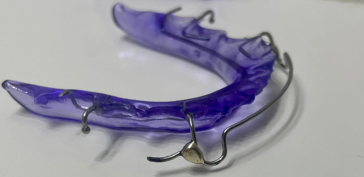 Custom Retainer with Soldered C Clasps