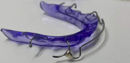 Custom Retainer with Soldered C Clasps
