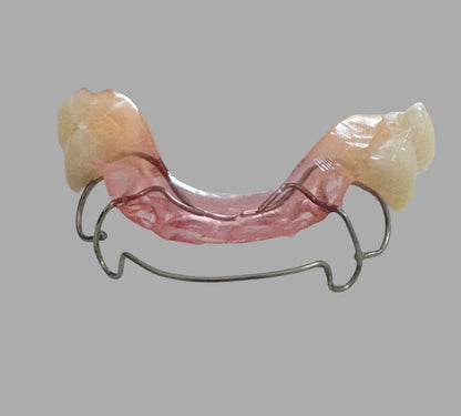 Hawley Retainer with Pontic Tooth