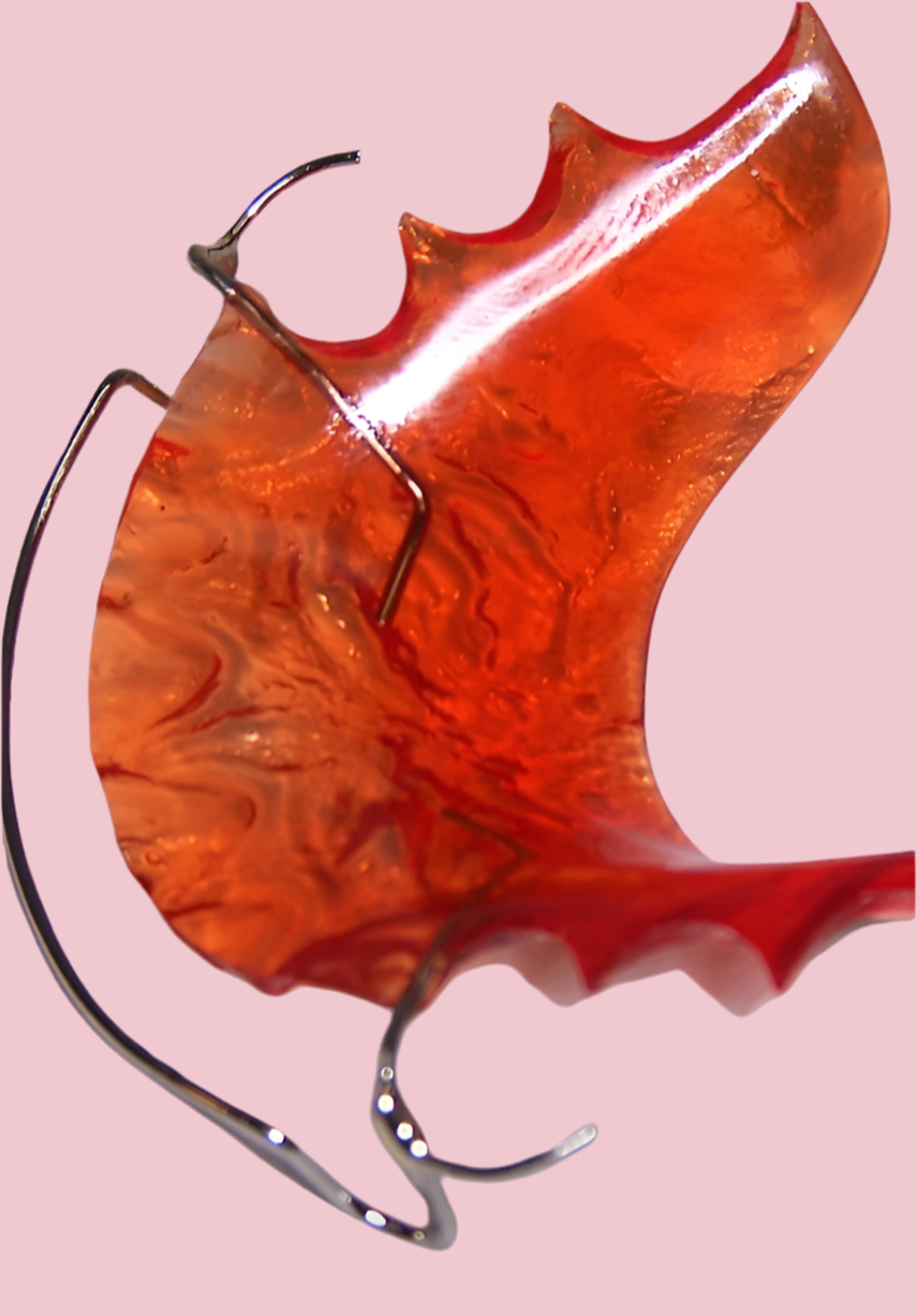“Dental retainer made from hard acrylic with clasps