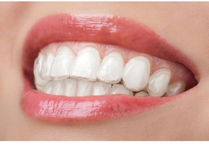 Clear Retainer
