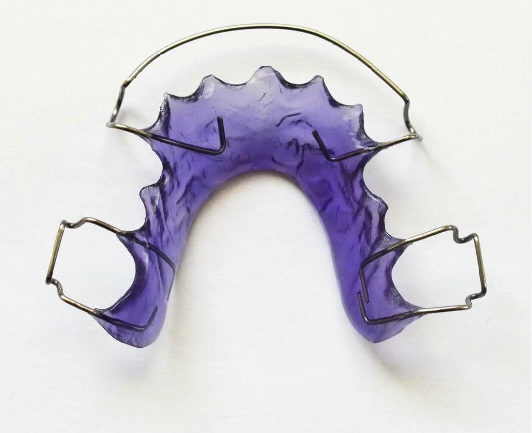 Orthodontic Retainer
